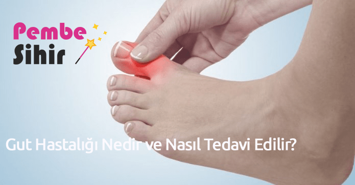 Gut Hastalığı Nedir ve Nasıl Tedavi Edilir