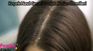 Kepek Nasıl Geçer? Doğal Çözüm Önerileri