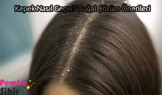 Kepek Nasıl Geçer? Doğal Çözüm Önerileri