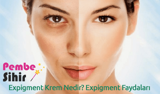 Expigment Krem Nedir Expigment Faydaları