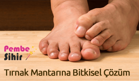 Tırnak Mantarına Bitkisel Çözüm