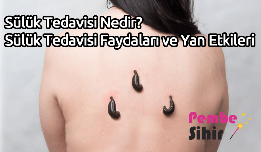 Sülük Tedavisi Nedir Sülük Tedavisi Faydaları ve Yan Etkileri