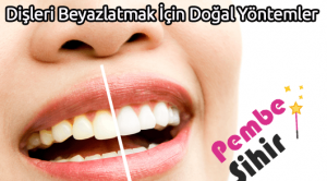 Dişleri Beyazlatmak İçin Doğal Yöntemler