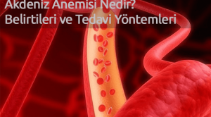 Akdeniz Anemisi Nedir? Belirtileri ve Tedavi Yöntemleri