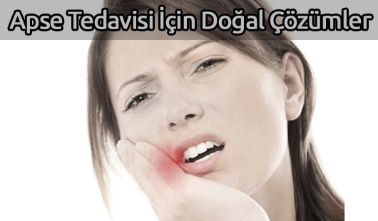 Apse Tedavisi İçin Doğal Çözümler