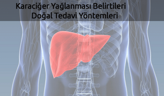 Karaciğer Yağlanması Belirtileri ve Doğal Tedavi Yöntemleri