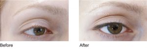 Eyeliner öncesi sonrası
